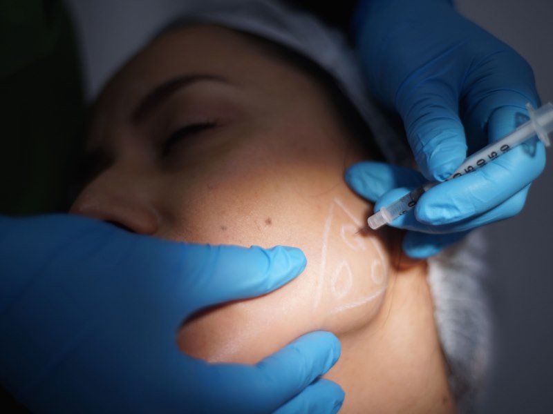 orthognathic-surgery-in-new-york